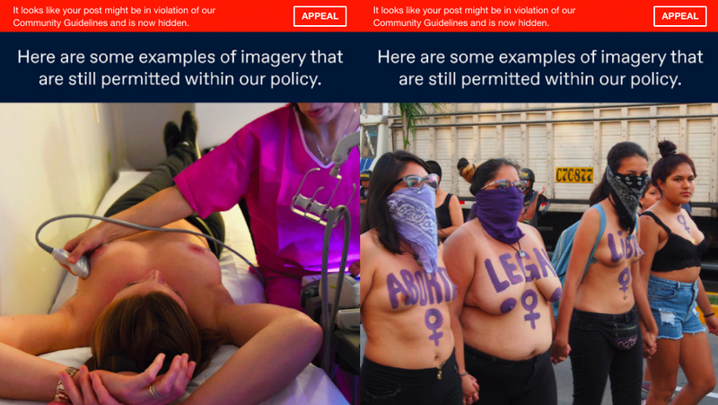 Illustration for article titled Tumblr's Porn Filter Flags Its Own Examples of 'Permitted' Nudity